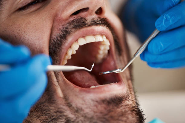 Best After-Hours Dental Trauma Care in Madison Center, CT