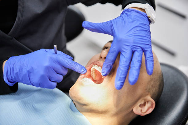 Best Emergency Wisdom Teeth Removal in Madison Center, CT